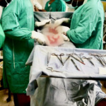 Notoperation einer jungen Frau mit Zwerchfelldurchbruch
